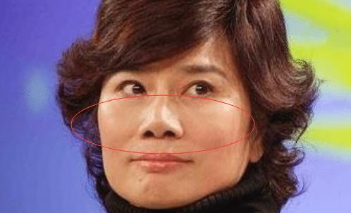 眼窝深颧骨高的女人面相