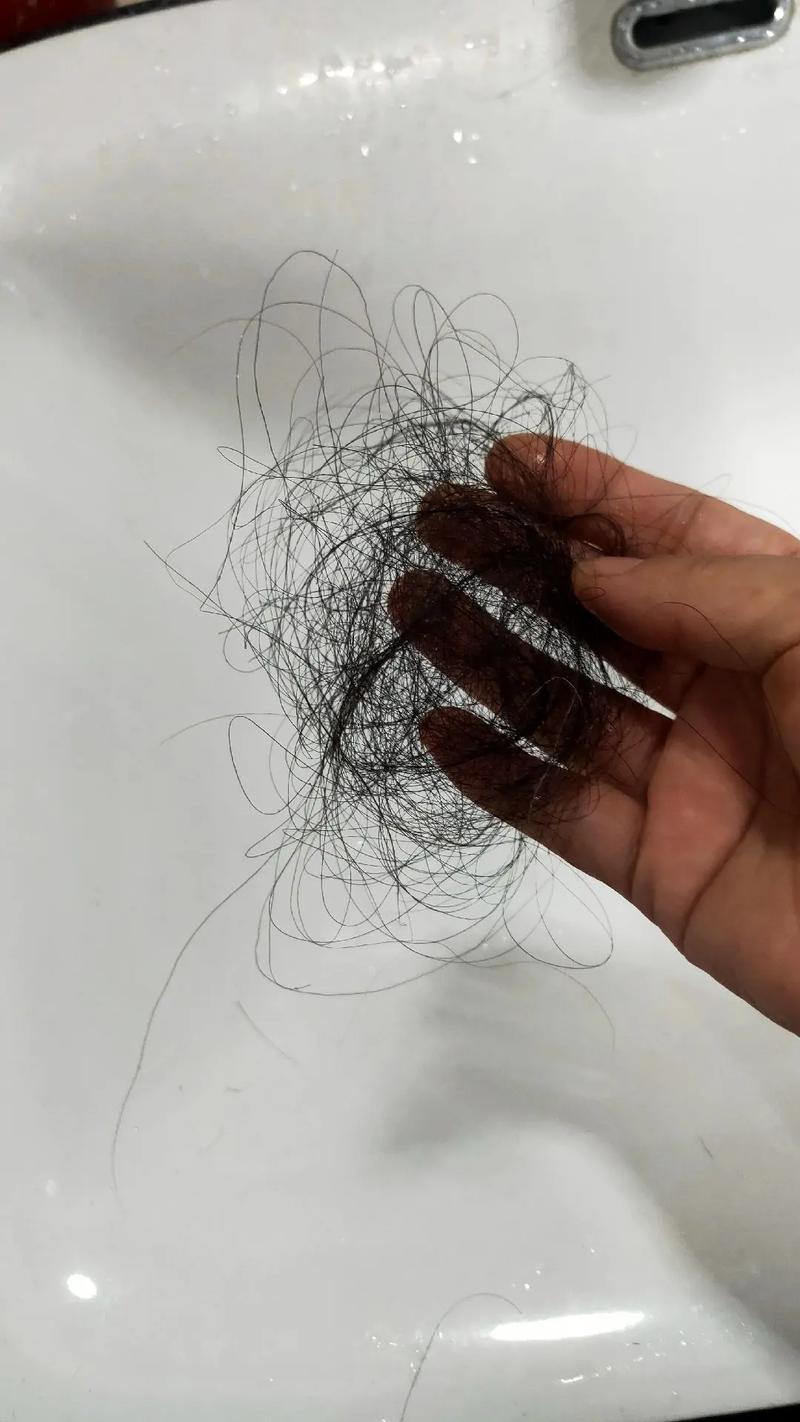 梦见梳头掉头发是什么征兆