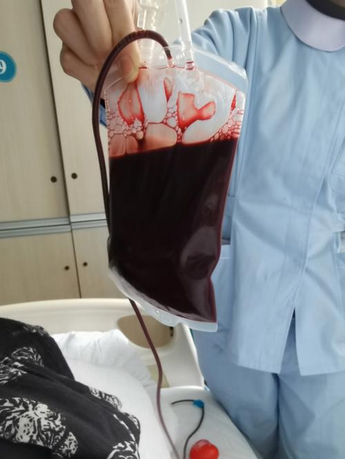 男性熊猫血对下一代影响