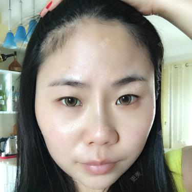 额头中间饱满两边凹陷怎么样