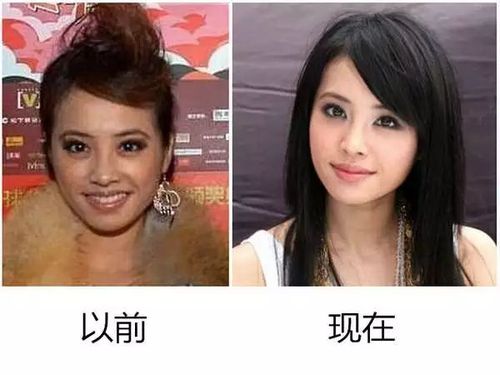 整容能改变命运吗