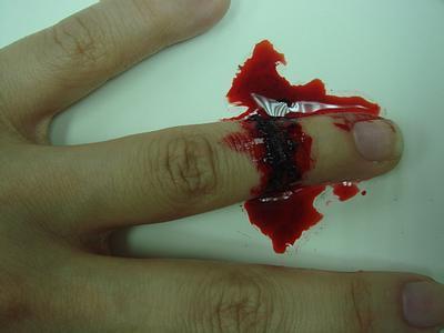 梦见腿上流血是什么预兆