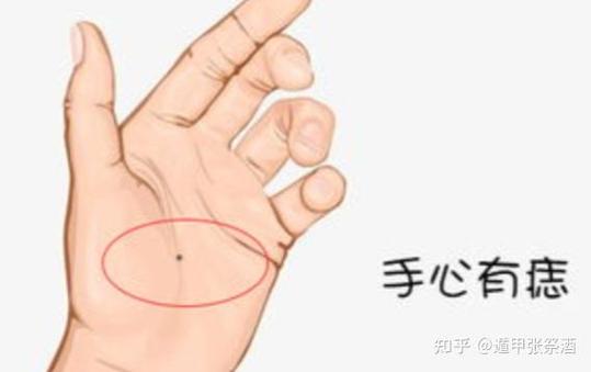 男人左边发际线边缘有痣