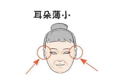 耳朵小但是双耳贴脑