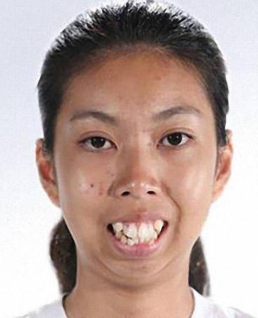 尖酸刻薄丑女面相