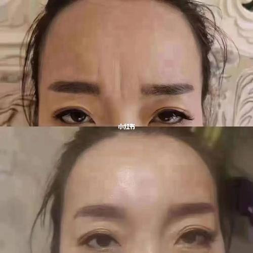 川字眉的女人面相,川字纹对女人的影响