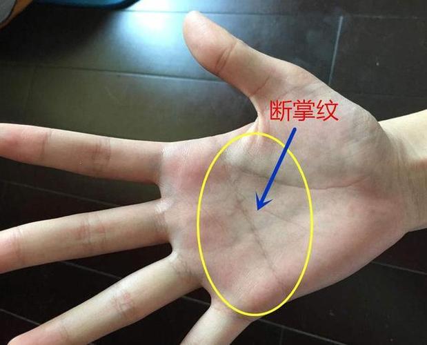 女人右手断掌大富大贵