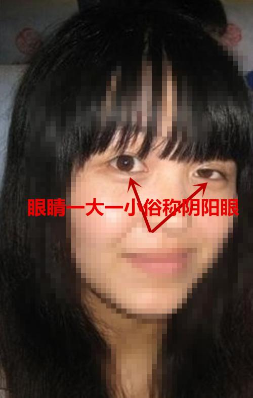 长阴阳眼的女生姻缘怎么样?