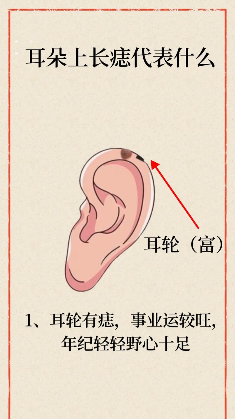 痣相的图解大全