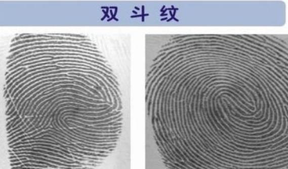 两个双斗纹智商高出常人