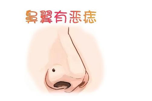 有痣相两个非字中间打一成语