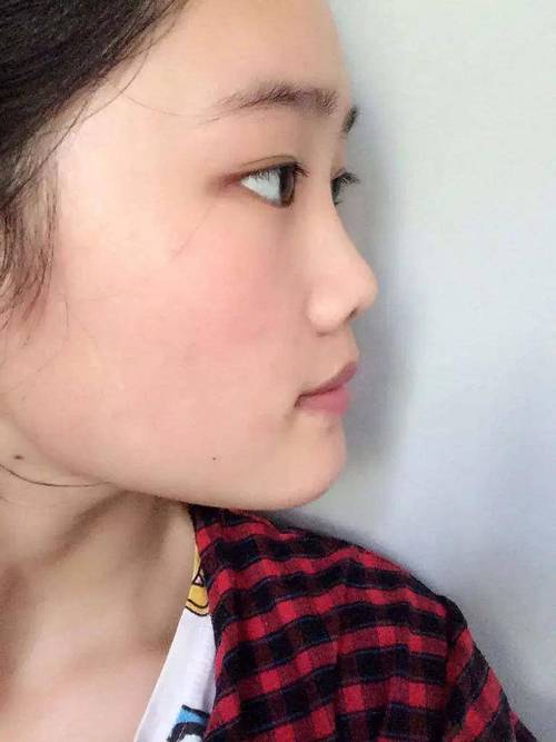 扁鼻子面相好不好