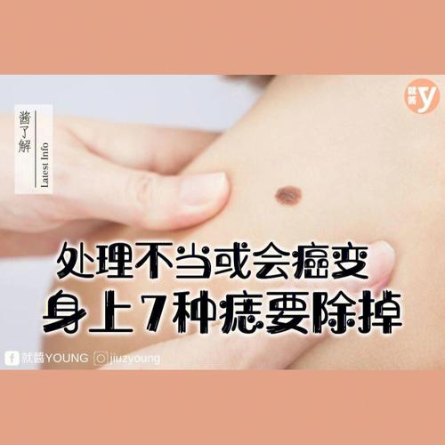 什么样的痣容易癌变?扼杀癌细胞