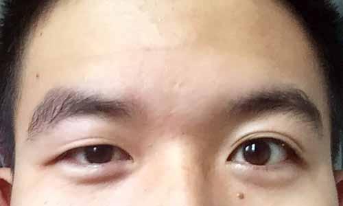 眼睛一大一小的面相