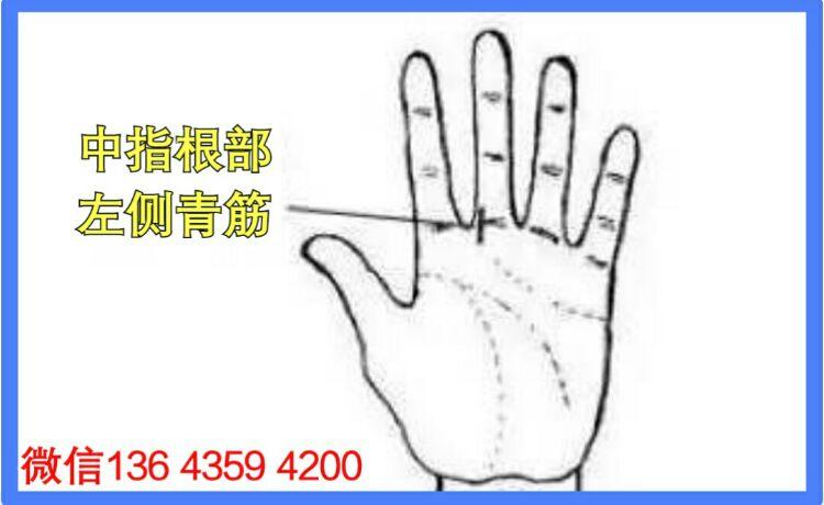 详解:青筋与命运