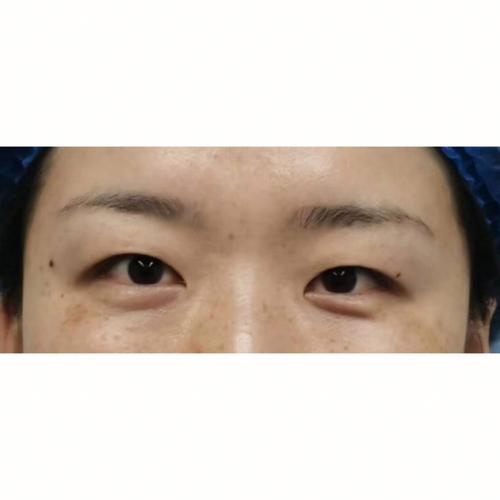 高低眉大小眼面相的吉凶程度如何