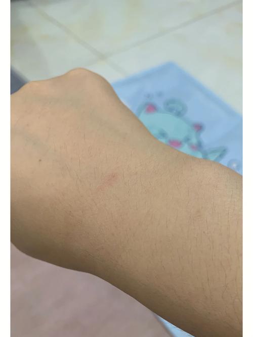 梦见被猫咬着手了有什么预示
