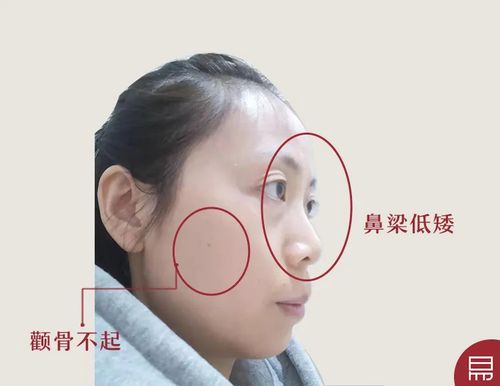 颧骨不对称是什么面相