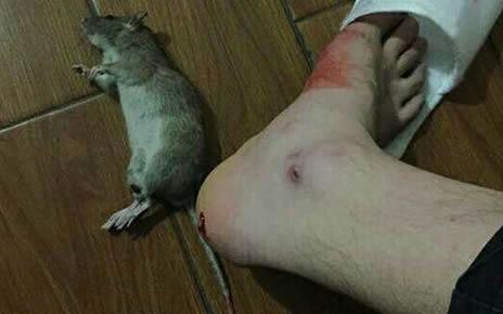 老鼠咬人