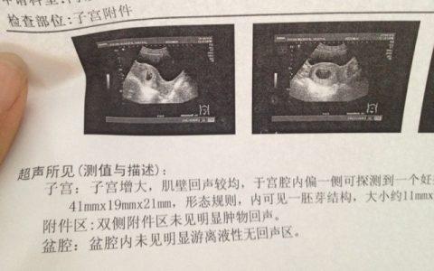 孕妈属相看男女