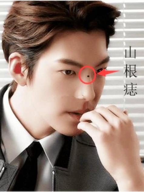 男人山根有痣好吗