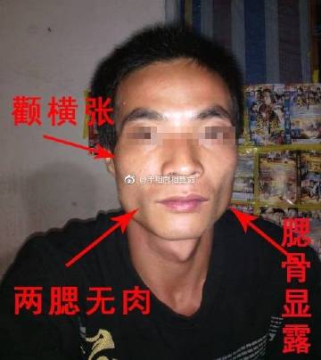 两腮无肉的男人面相如何