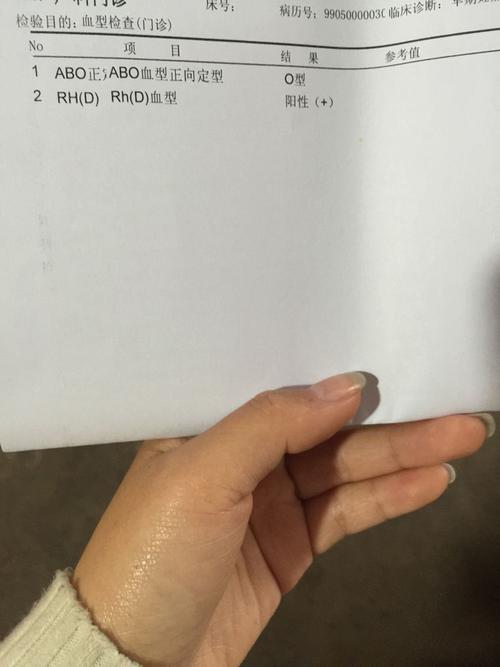 o型rh阳性血稀有么