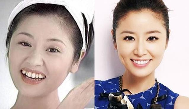 面相分析:女人地包天面相好吗?