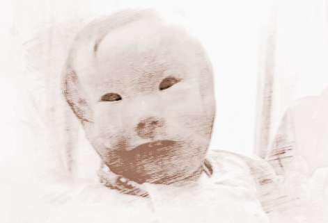 梦见畸形儿