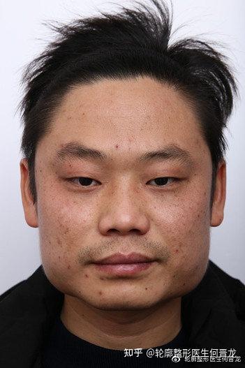 男人脸下巴两边宽好不好