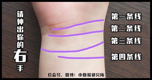 手腕三条纹代表什么