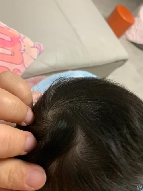 女孩头上两个旋很凶吗