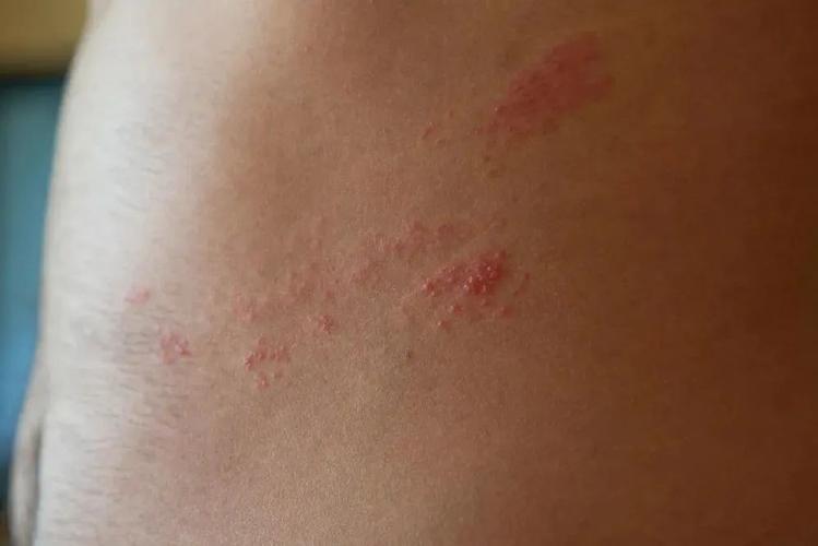 梦见蛇缠腰上是什么意思