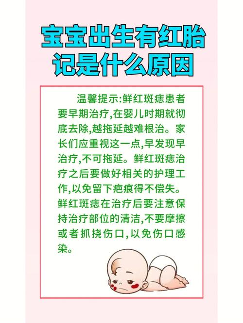 总是有故事!身上有胎记的传说
