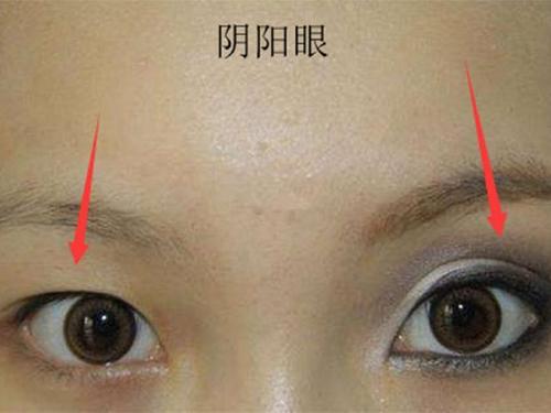 究竟有没有拥有阴阳眼的人?