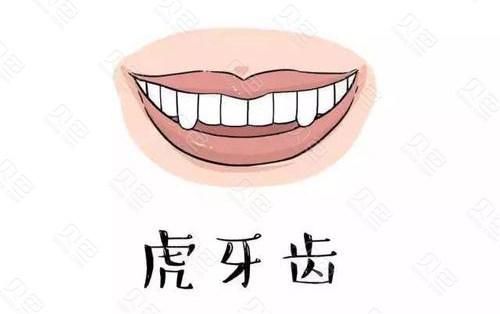 有虎牙是什么意思？