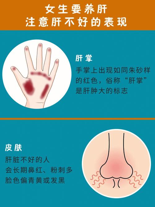 手掌红和肝掌区别图解
