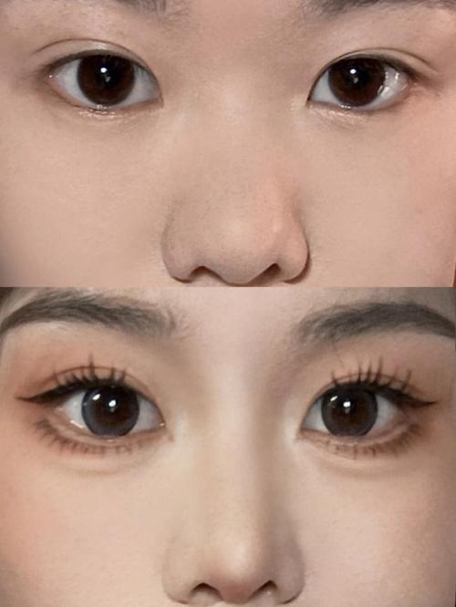 鼻梁塌的女人命运