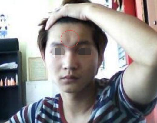 印堂低陷的人命运怎样