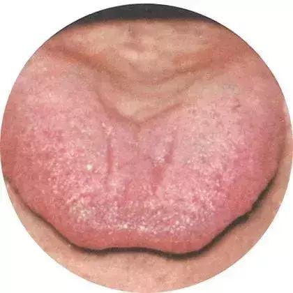 通过舌头看出人生百态