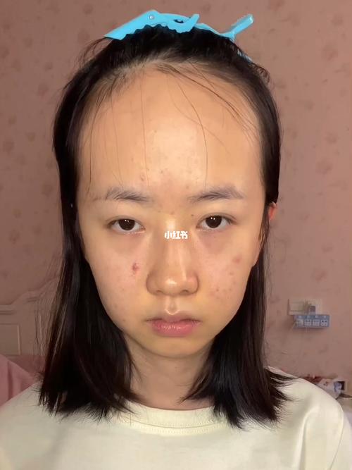 女人发际线高是命苦吗