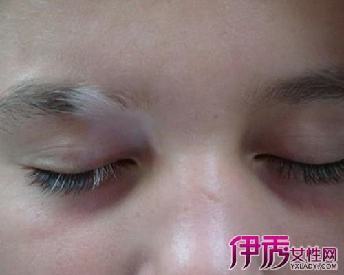 梦见眉毛变白了是什么意思