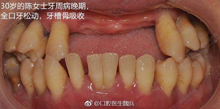 梦见下牙槽拿在手里