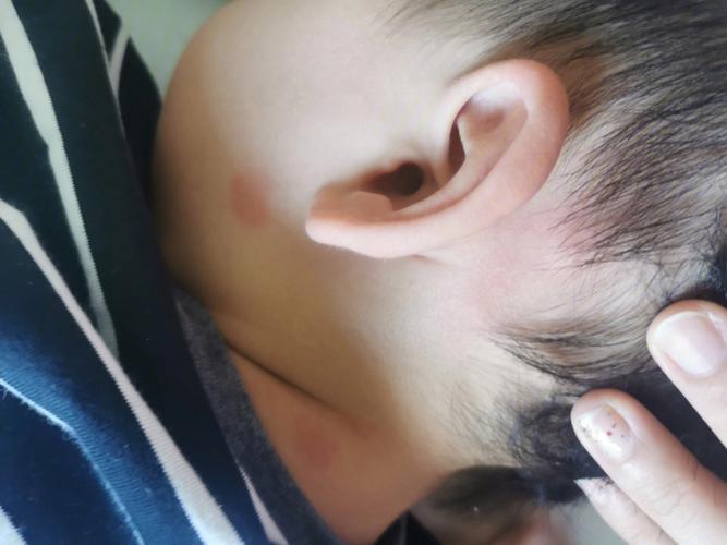 如何能让O型血宝宝茁壮成长