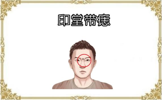 男人印堂有痣图片