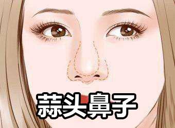 蒜头鼻面相好不好