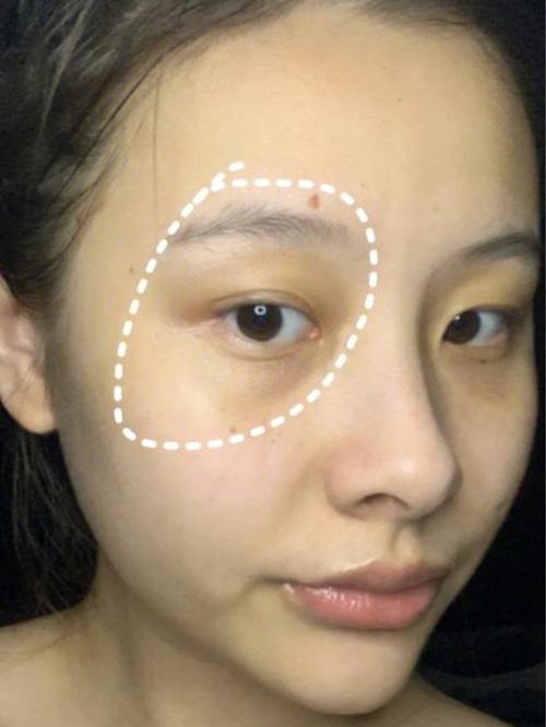 女人天生有黑眼圈命运好不好?