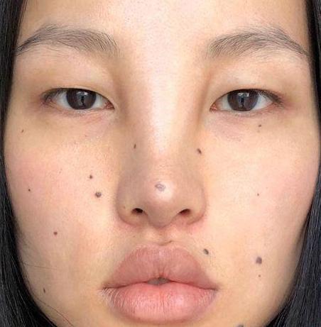 拥有杀子痣的面相在职场会混得怎么样呢