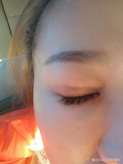 女人眼角有疤对命运有哪些影响