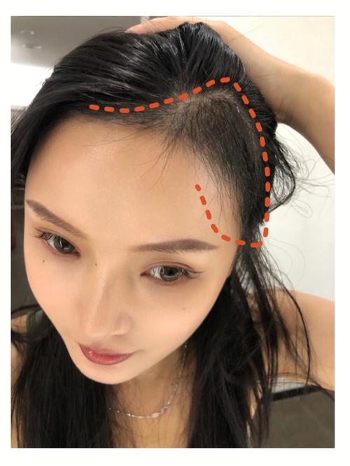 发际线上有旋的人命好不好